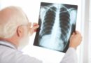 AI Model Enables Earlier Detection of Diabetes Through Chest X-Rays